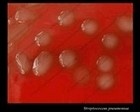 Streptococcus pneumoniae hemolysis on blood agar